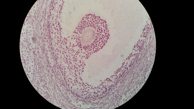Ovary Graafian Follicle Slides - Ovary Graafian Follicle 011 400X